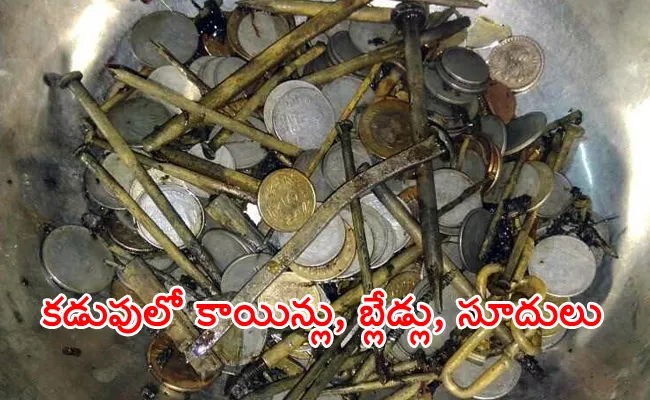 263 Coins, Shaving Blades, Needles Found In Madhya Pradesh Man's Stomach - Sakshi