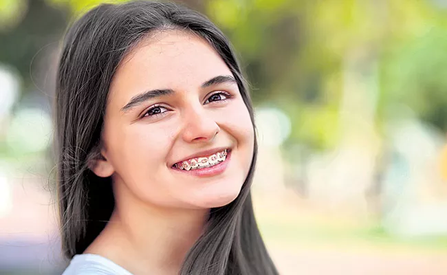 Clips are very important for the first two weeks in the treatment of orthodontic - Sakshi