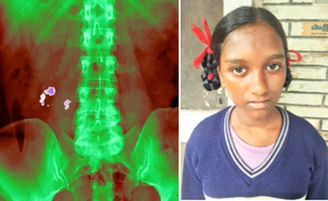 Seventh Class Girl Suffering With Kidney Infection in Visakhapatnam - Sakshi