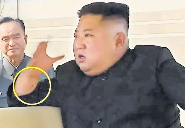 North Korea dictator Kim Jong Un surfaces on state media with mark on wrist - Sakshi
