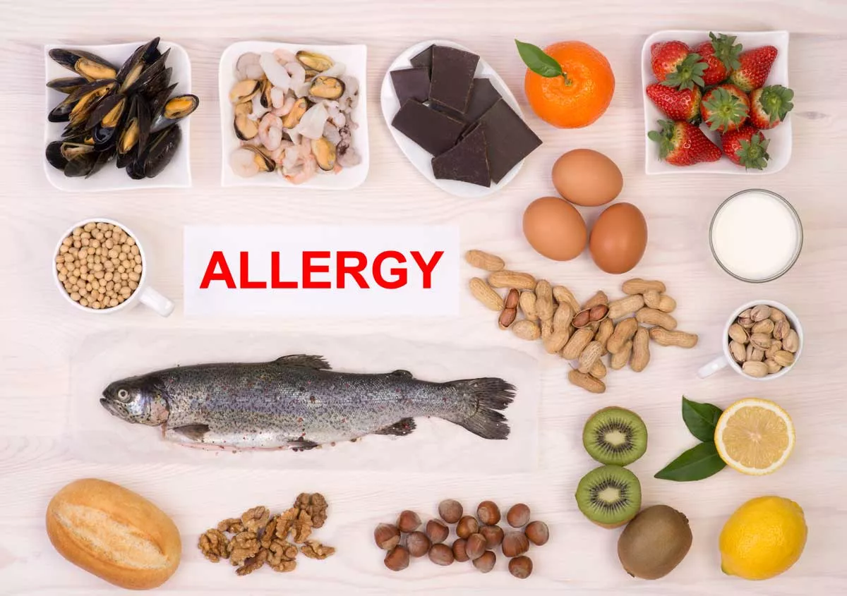 Allergies Like Skin Food Treatment Avoid Taking Precautions Doctor Advice - Sakshi