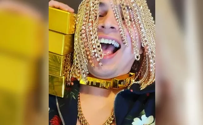 Mexican Rapper Dan Sur Implanted Gold Chains As Hair - Sakshi