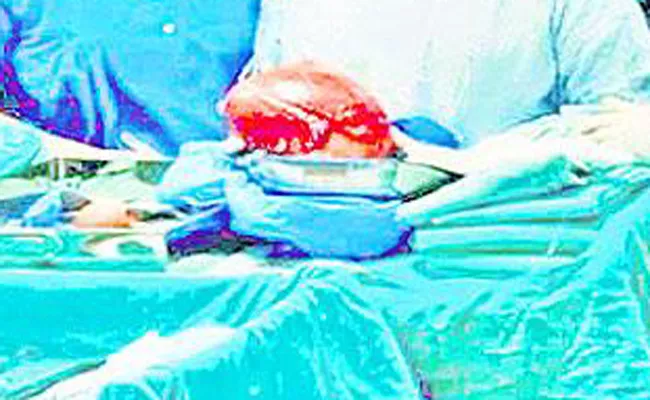 Rare surgery successful in Vijayawada government hospital - Sakshi