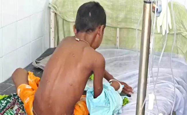 Monkeypox Suspected Case In Guntur Boy Admitted In GGH hospital - Sakshi