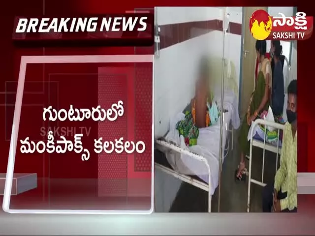 Monkeypox Suspected Case In Guntur District