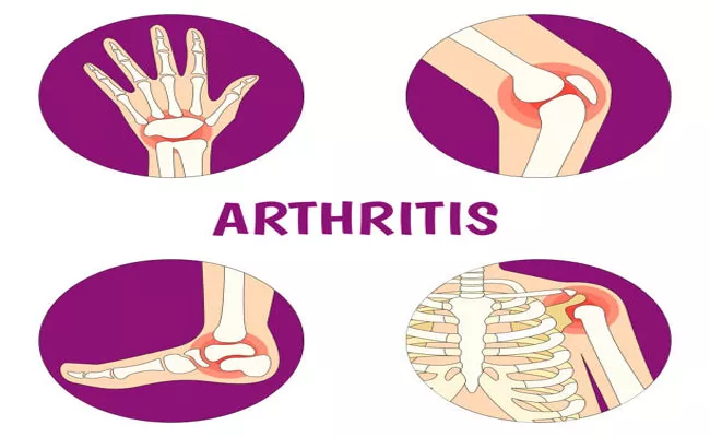 Awareness On Arthritis On World Arthritis Awareness Day - Sakshi