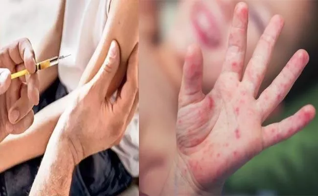 160 Cases Of Measles Outbreak Reported In Kerala - Sakshi