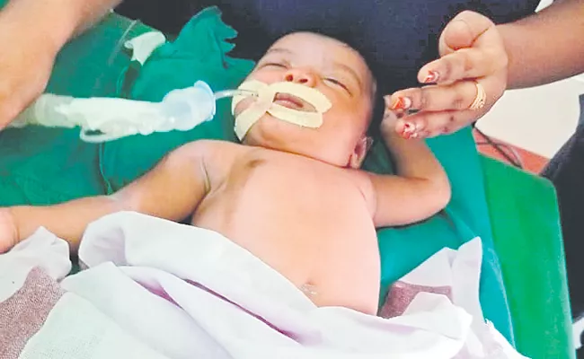 Rare surgery for 22 day old baby Andhra Pradesh Vijayawada GGH - Sakshi