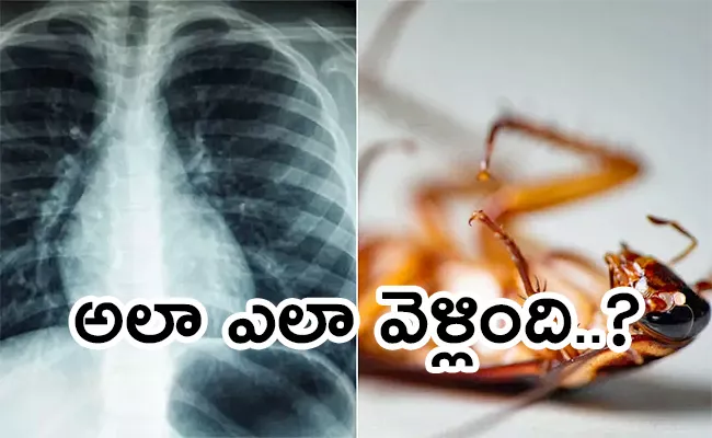 Kerala Doctors Remove Cockroach From Mans Lungs - Sakshi