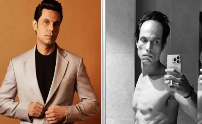 Randeep Hooda On Drastic Transformation: Reveals Shocking Side Effects - Sakshi