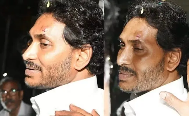 Strong attack on CM YS Jagan with a sharp object - Sakshi
