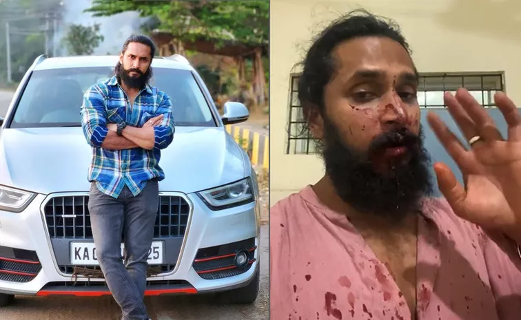 Kannada Actor Chetan Chandra Attacked by Mob In Bengaluru
