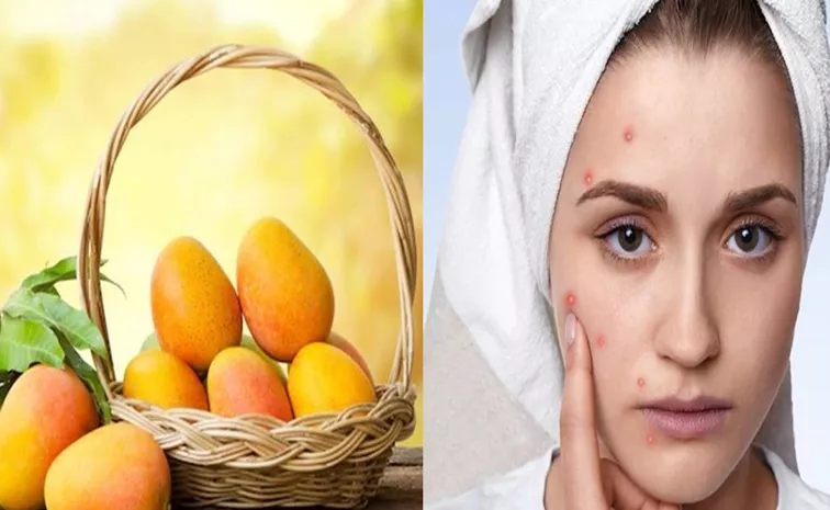 Eating Mangoes Causes Pimples Is It Myth Or Fact